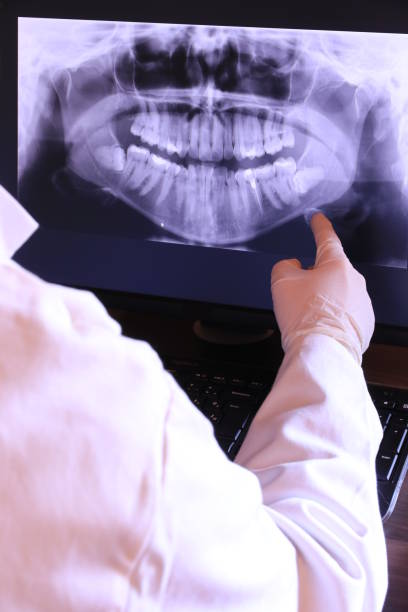 Best Broken or Cracked Tooth Emergency Dentist in Shaker Heights, OH