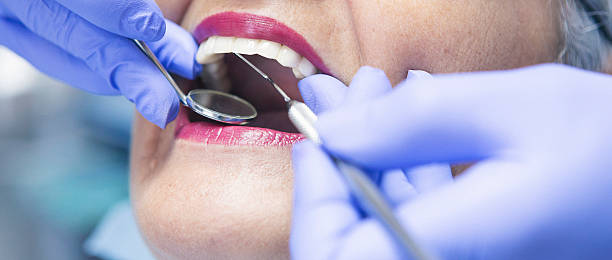 Best Emergency Cosmetic Dentistry in Shaker Heights, OH